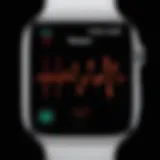 Detailed view of the ECG feature on Apple Watch